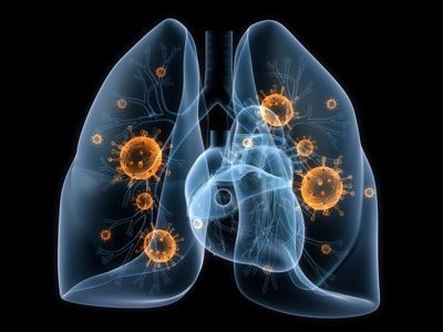 4 thói quen khiến bạn rơi vào nhóm có tỷ lệ mắc ung thư phổi cao. XEM NGAY ĐỂ TRÁNH!